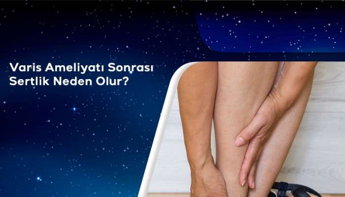 Varis Ameliyatı Sonrası Sertlik